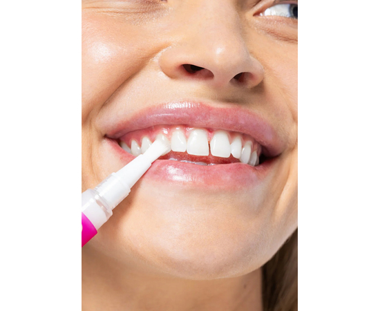 SmileKit PAP+ Отбеливающий карандаш для зубов, 3 мл, изображение 3