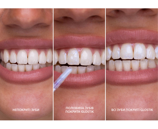 SmileKit Glostik Блеск для зубов, 4 мл, изображение 5