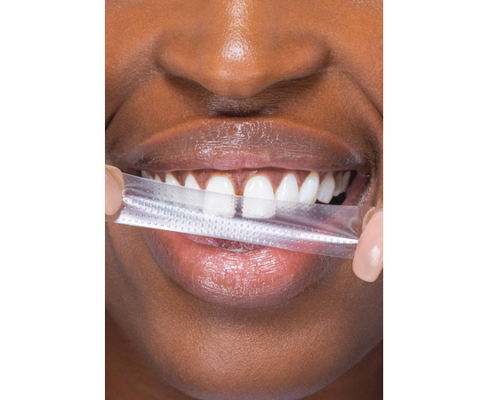 SmileKit PAP+ Отбеливающие полоски для зубов, 28 шт./14 пар, изображение 6